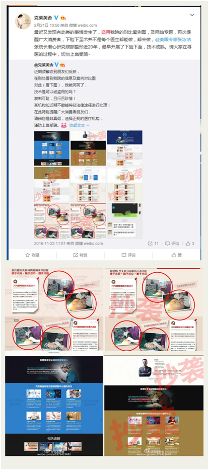 就张冰洁院长外眦角开大,外眼角修复抄袭事件正式声明!