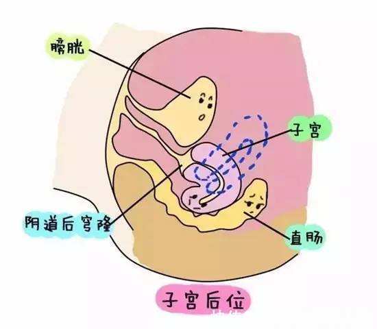 当膀胱空虚时,站立位的子宫位置一般呈轻度的前倾前屈位,也就是我们