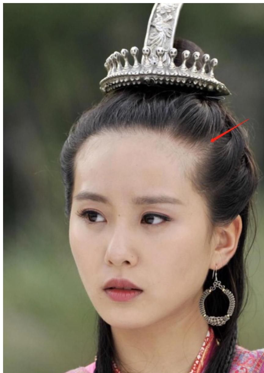 长得好看都难逃秃头?刘诗诗两鬓秃得很特别,跟杨幂鞠婧祎有一拼