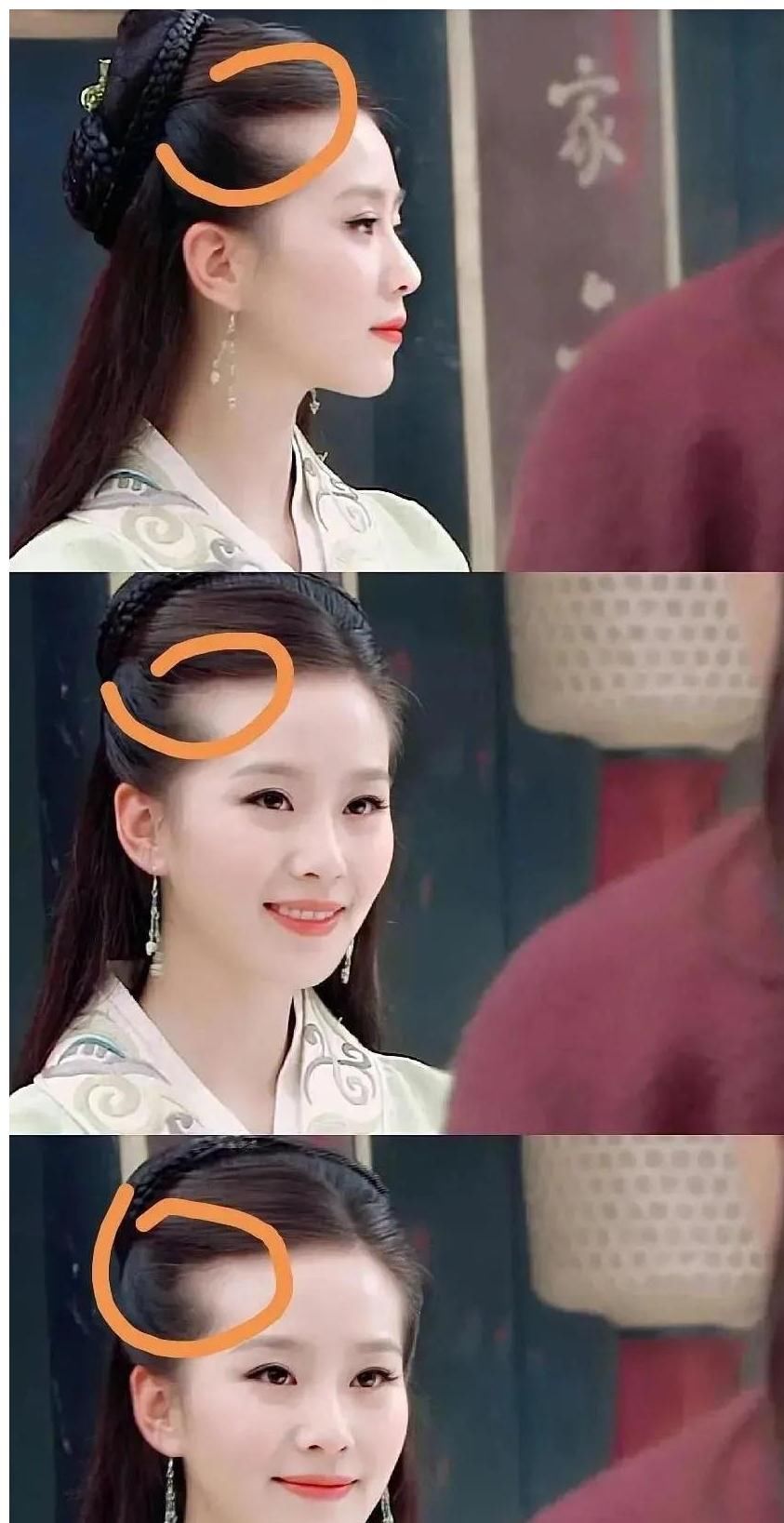 长得好看都难逃秃头?刘诗诗两鬓秃得很特别,跟杨幂鞠婧祎有一拼
