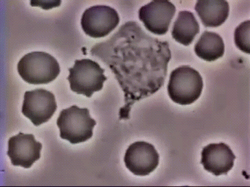 要是失去了白细胞的免疫功能,即使微不足道的细菌也能让大内久死亡.