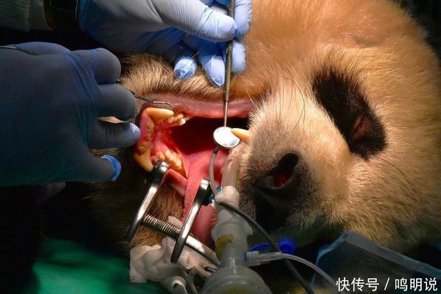 大熊猫家族 护牙 换假牙 全世界第一只戴钛合金牙套的大猫熊 快资讯 大熊猫家族 护牙 换假牙 全世界第一只戴钛合金牙套的大猫熊 快资讯