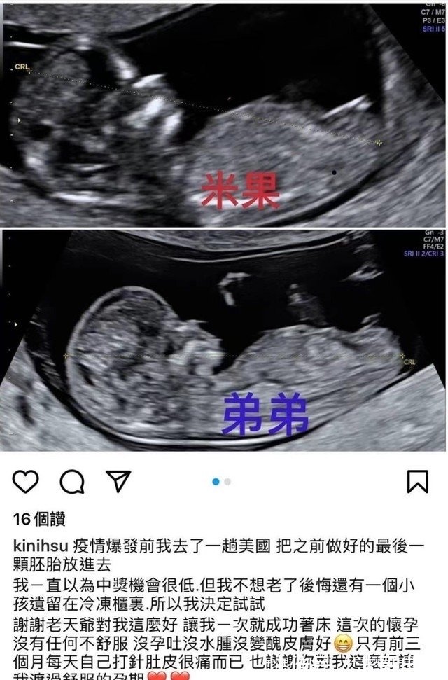 罗志祥43岁经纪人小霜宣布怀二胎 仍是试管婴儿 孩子父亲不详 快资讯