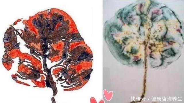 胎盘完成使命后 都咋处置的柬埔寨埋树下 看到德国难以下咽 快资讯