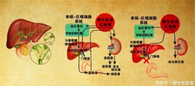 总胆红素 间接胆红素和直接胆红素偏高是什么原因造成的 快资讯