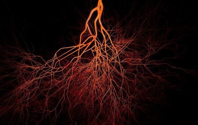 经常运动血管还会 堵 营养学家 保养血管做好这3件事就行了 快资讯 经常运动血管还会 堵 营养学家 保养血管做好这3件事就行了 快资讯