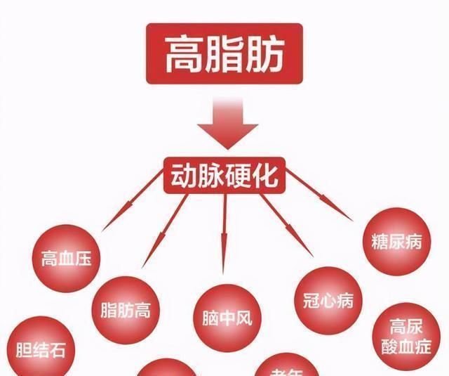 3种早餐胆固醇含量比肥肉还高 不想血管被堵 尽早撤下桌 快资讯