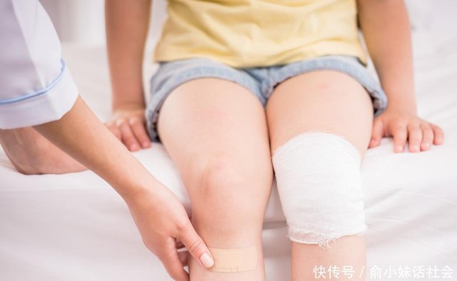 20200727 骨折癒合後還是會痛 長庚骨科醫師教4階段防止癒合不全 廣川醫院