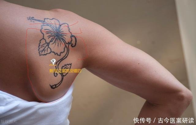 天宗穴 在肩胛骨窝里面 按一按 灸一灸 专治肩胛痛 肩膀痛 快资讯 天宗穴 在肩胛骨窝里面 按一按 灸一灸 专治肩胛痛 肩膀痛 快资讯