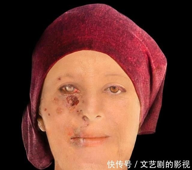 英国法医重建500年前麻风病人的 烂脸 还有900年前的正常脸 快资讯 英国法医重建500年前麻风病人的 烂脸 还有900年前的正常脸 快资讯