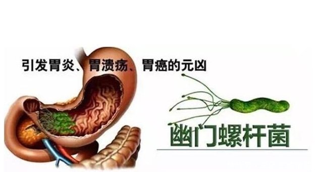 黑糯米与此物搭配 开挂养胃 赶走幽门螺旋杆菌 胃炎好了 快资讯