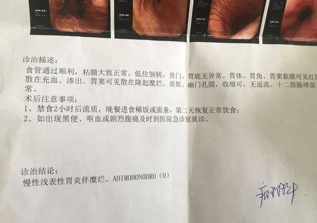 20岁少女幽门菌值高达2200 查杀3次 成功消菌 快资讯