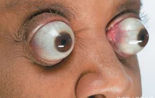 令人惊讶的吉尼斯世界纪录：世界上大的眼珠子,看完有点吓人!