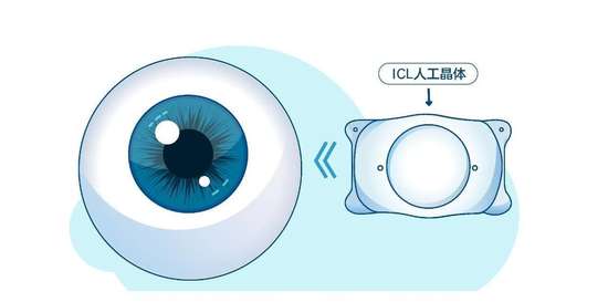 你的眼睛能起什么作用