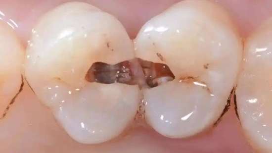 研究发现经常午睡的人