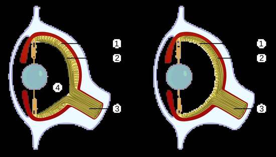 章鱼眼睛是什么颜色