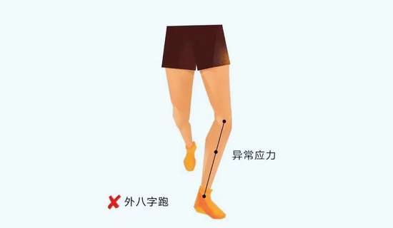 跑姿不对会导致什么后果