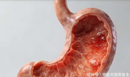 胃炎是胃黏膜受损吗