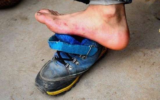 生长痛有办法缓解吗