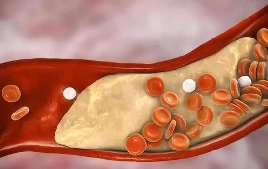 60岁以后胆固醇不能超过多少