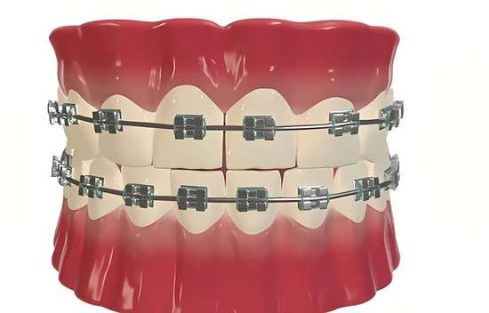 什么情况下需要做正畸