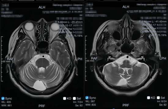 注意身体出现这9种信号要小心了