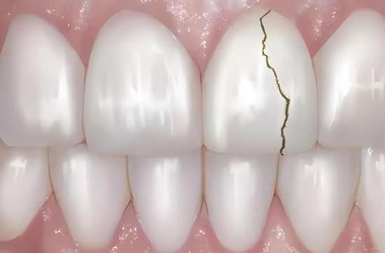 为什么牙齿会莫名其妙疼