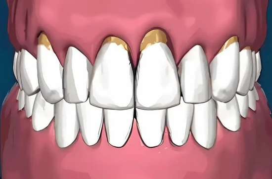 牙根越来越长是怎么回事