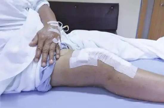 骨质疏松患者吃钙片的最佳时间