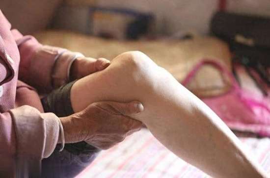 天气变凉类风湿性关节炎疼痛加剧