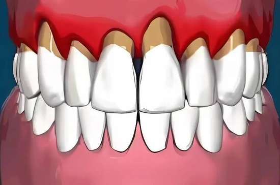 人老了就一定会老掉牙嘛