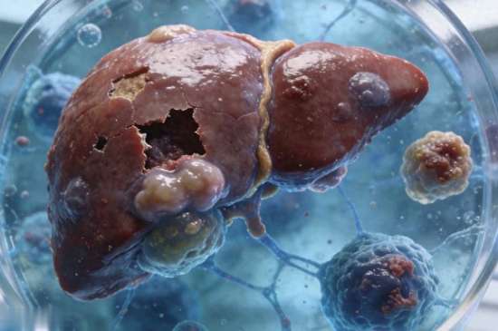 酒精肝严重了会怎么样