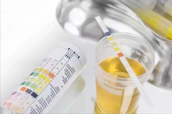 有没有肾结石看看脚就知道了