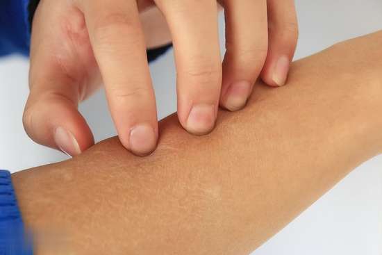 女性雌激素过多吃什么食物