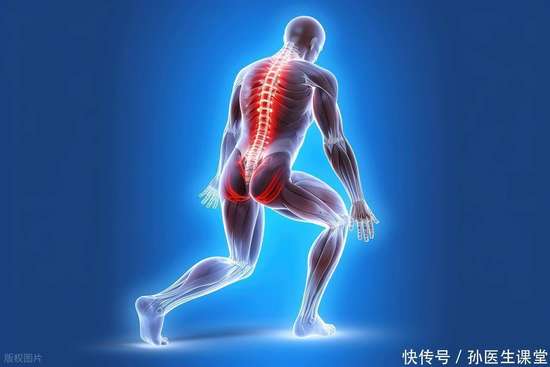 腰椎间盘突出有三种类型