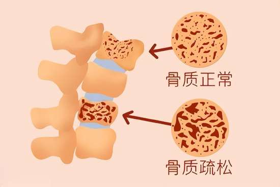 女性雌激素过多吃什么食物