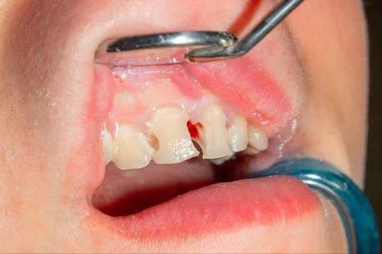 口腔出现五种迹象或是癌症的信号