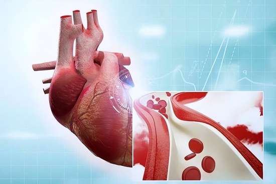 冠心病千万别碰的五种食物