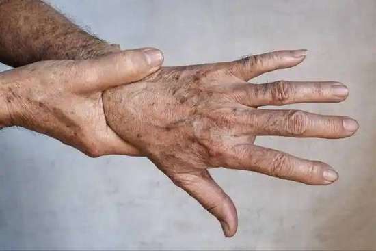 坚持吃半年花生