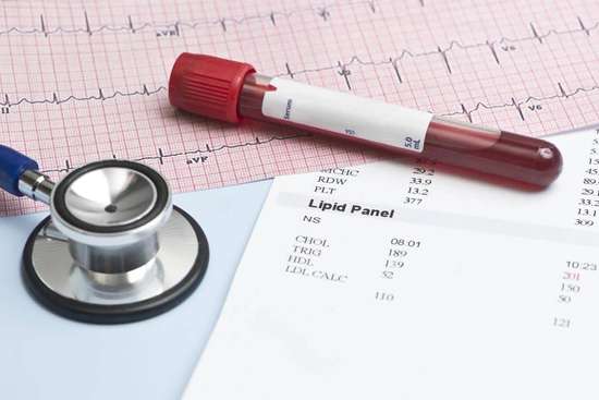 西兰花血脂高能吃吗