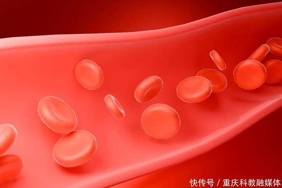 血管斑块最新研究进展