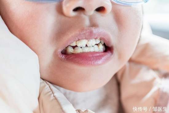 湿气重医生开了三种药