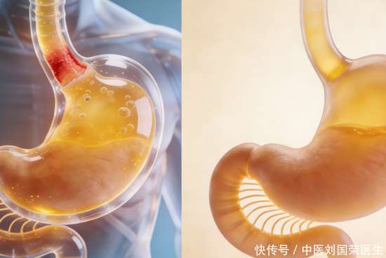 饭后总是烧心反酸怎么回事