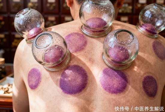 拔罐走罐的副作用
