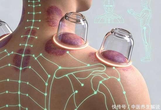 拔罐三大禁忌穴位图