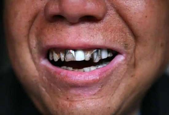 医生劝老人4个方法