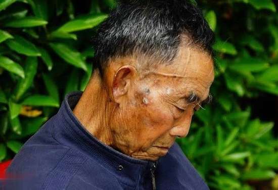 糖尿病不吃主食会怎么样