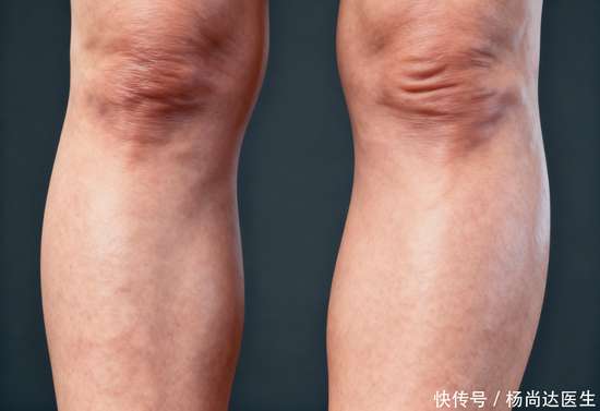 身体若有这3种异常请及时就医