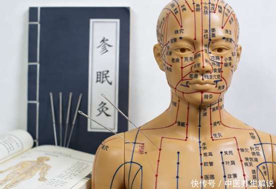 针灸能根治长期失眠吗