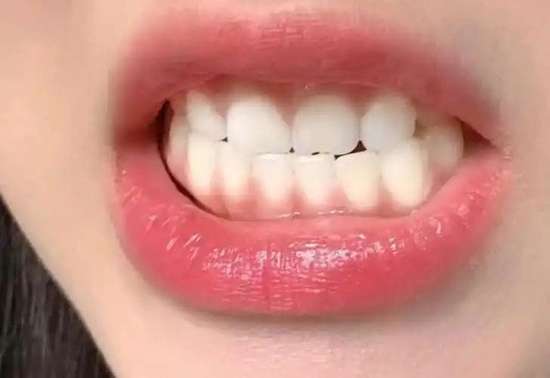 研究发现经常午睡的人